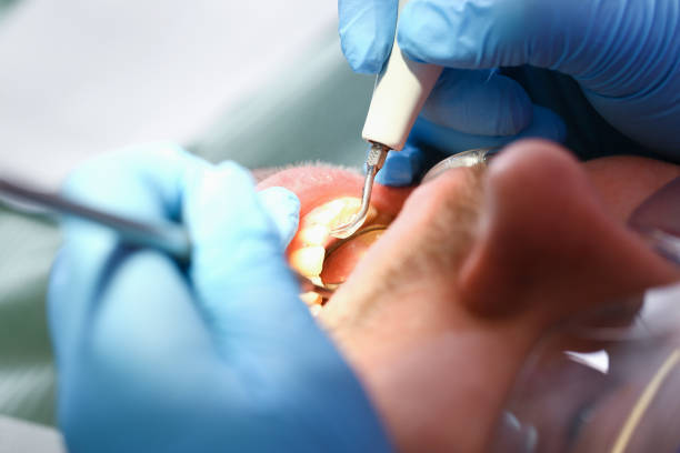 Best Emergency Dental Extractions in Wallburg, NC